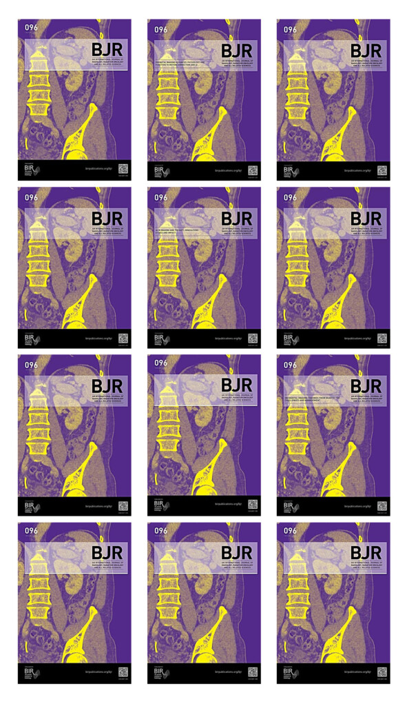 British Journal Of Radiology 2023 Full Archives True PDF Afkebooks 